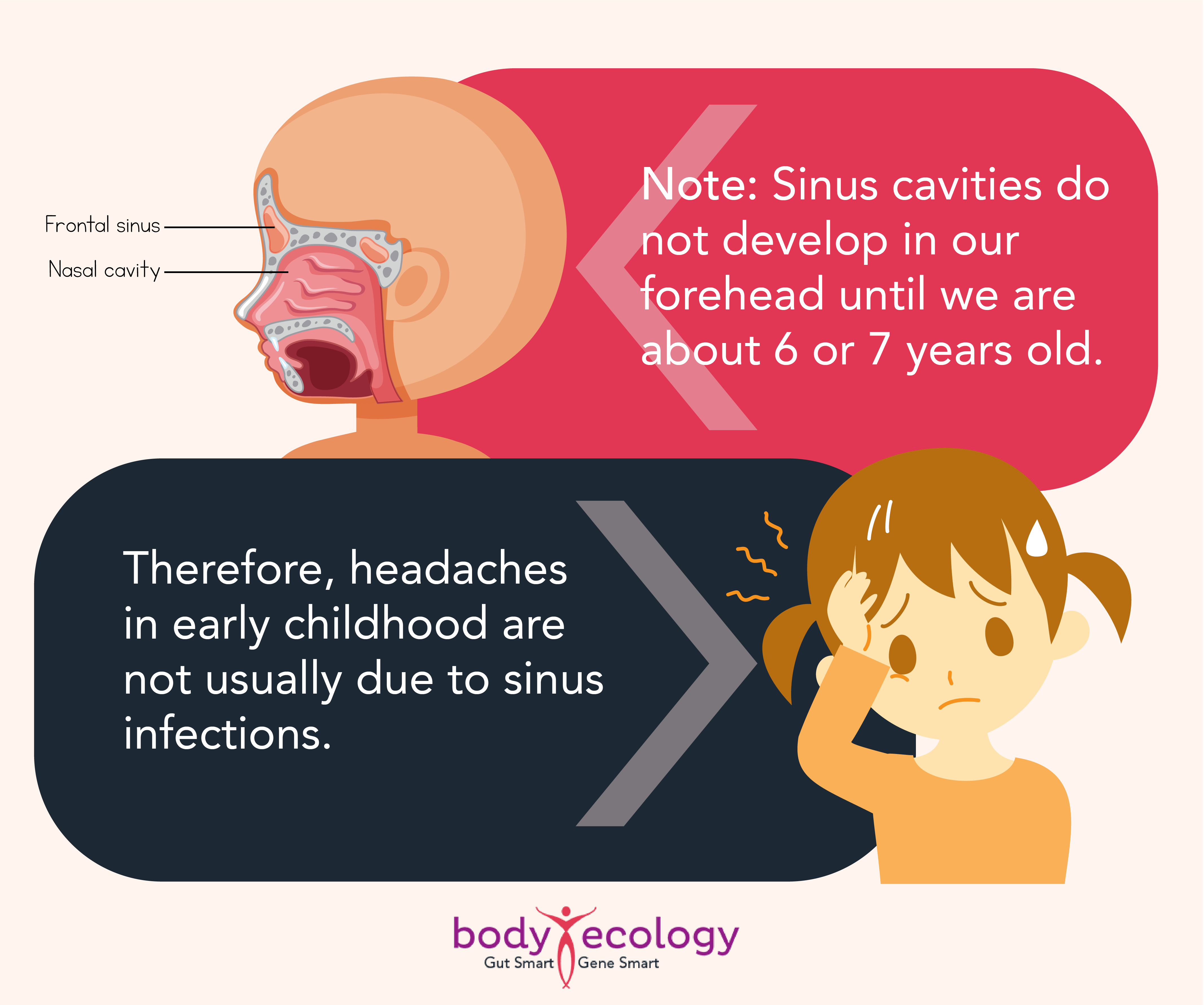 sinusitis
